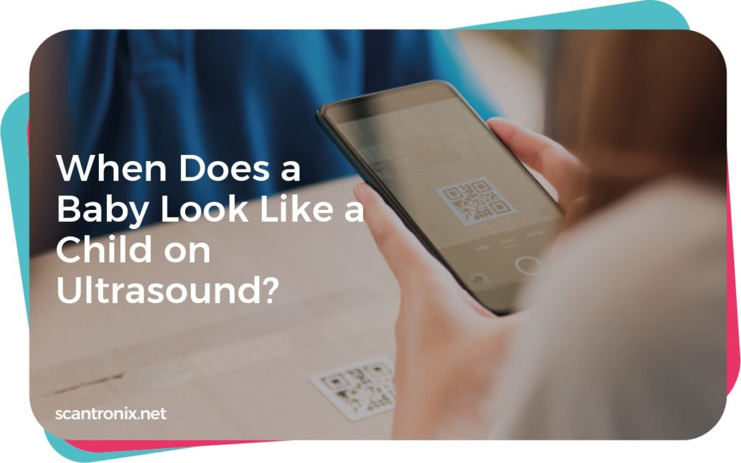 When Does a Baby Look Like a Child on Ultrasound?